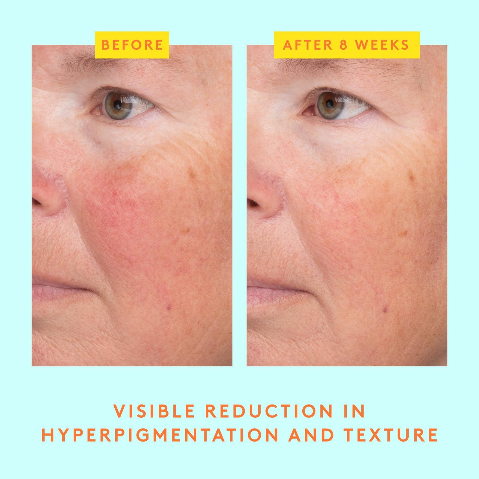 C-Luma Hydrabright Serum
