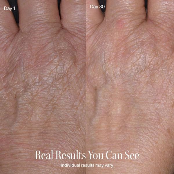 Solawave Radiant Renewal 2-in-1 Skincare Mini #6