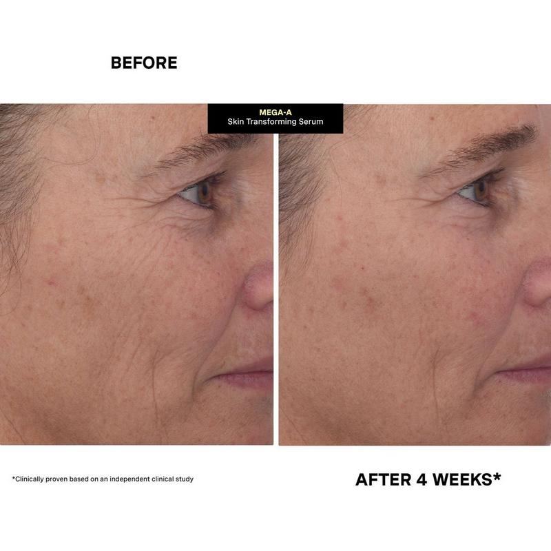 Kate Somerville - MEGA-A Skin Transforming Serum | Ulta Beauty