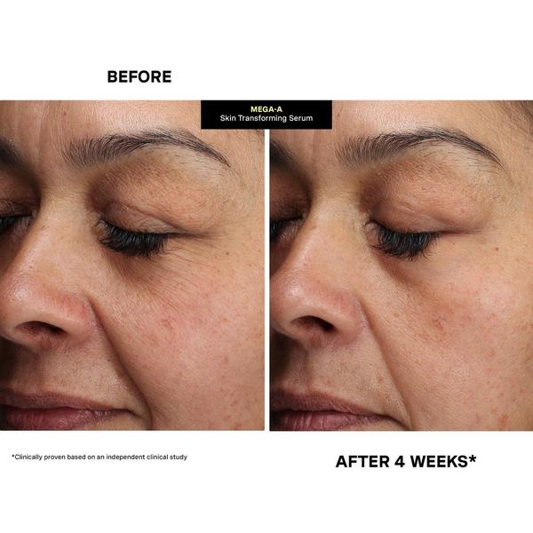 Kate Somerville MEGA-A Skin Transforming Serum #3