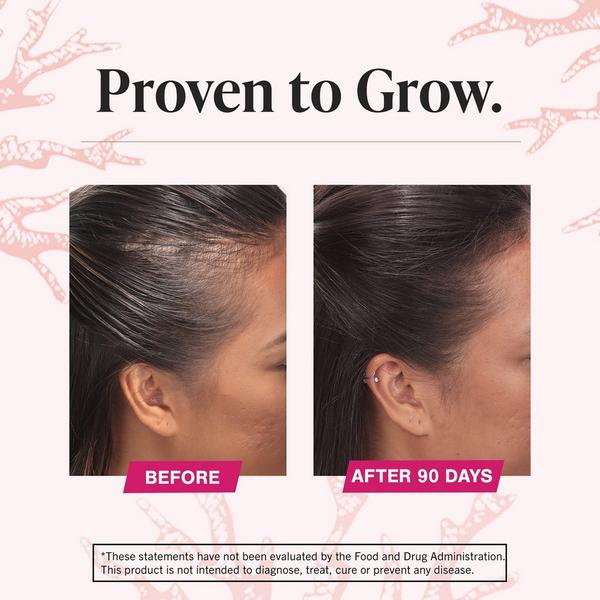 Viviscal Hair Growth Supplements for Women #6