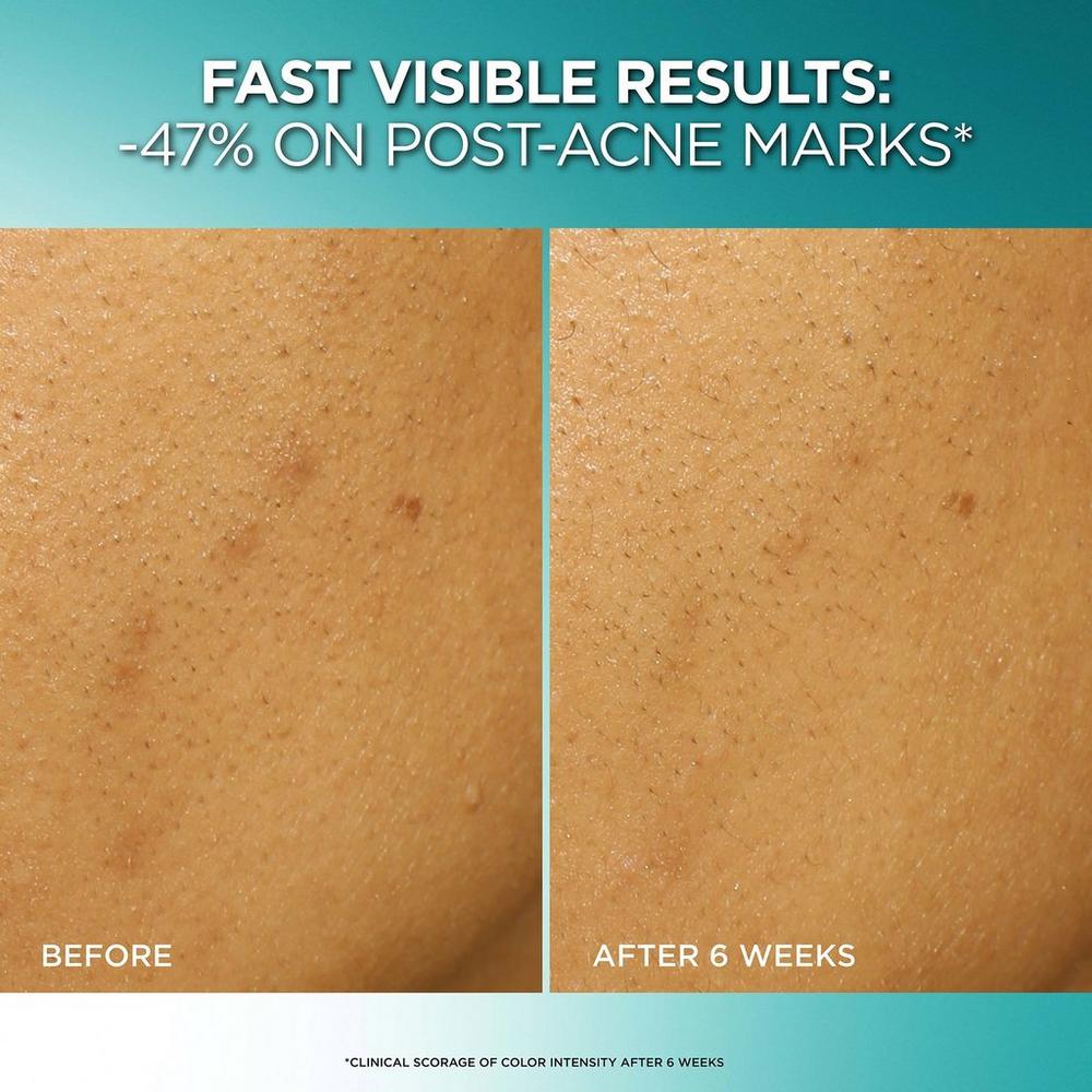 Bright Reveal Dark Spot Exfoliant Peel