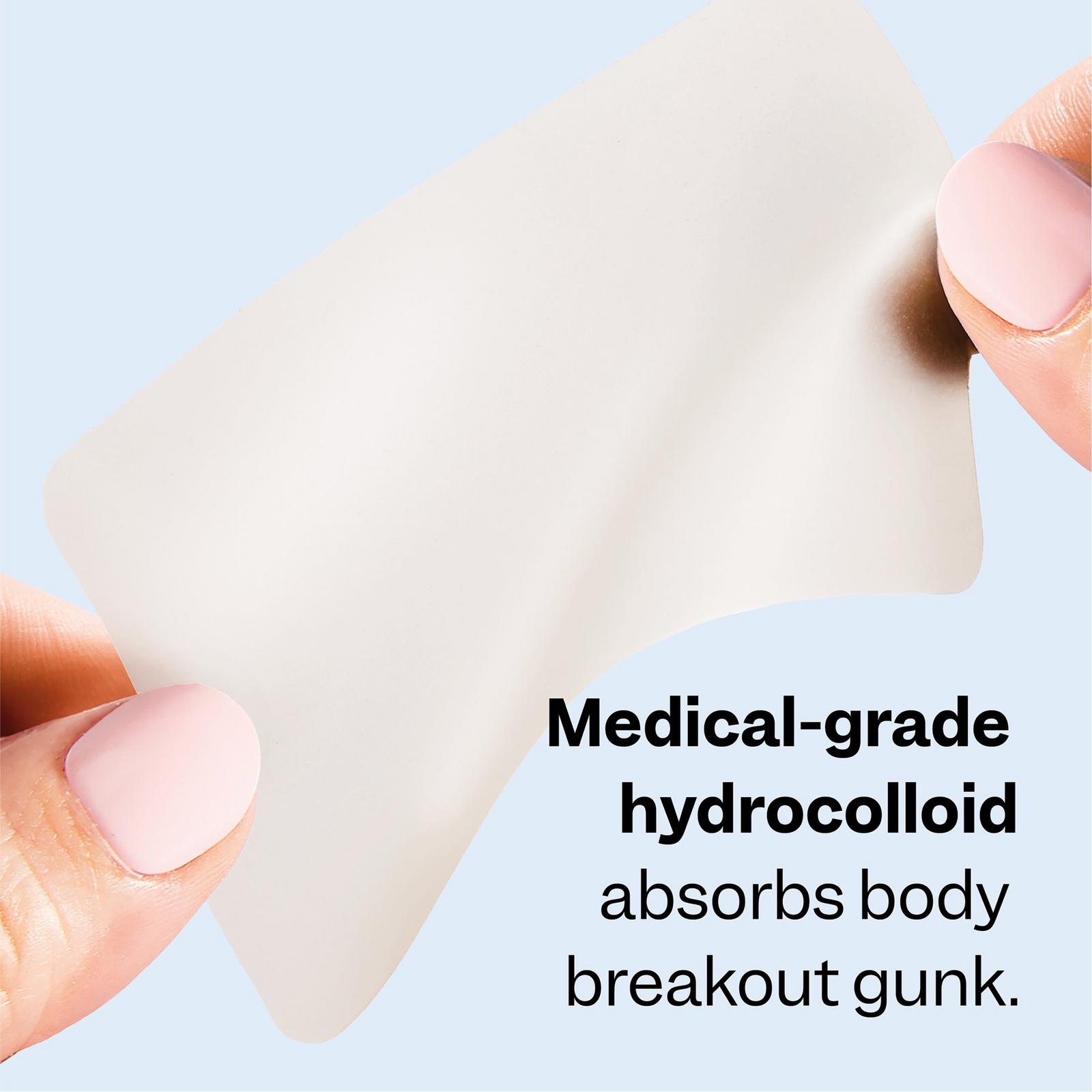 Body Breakout Patches