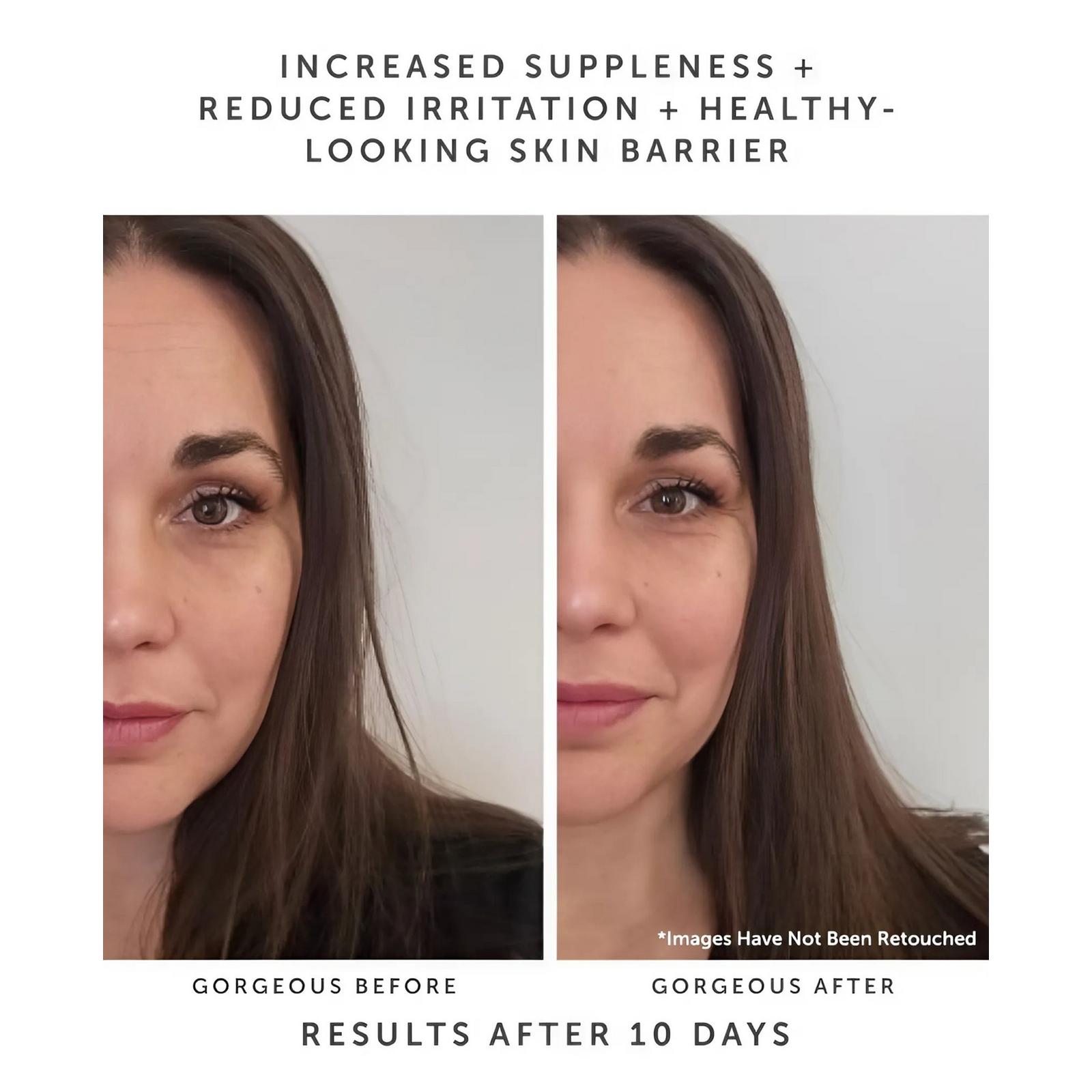 Horizon Ceramide Recovery Serum