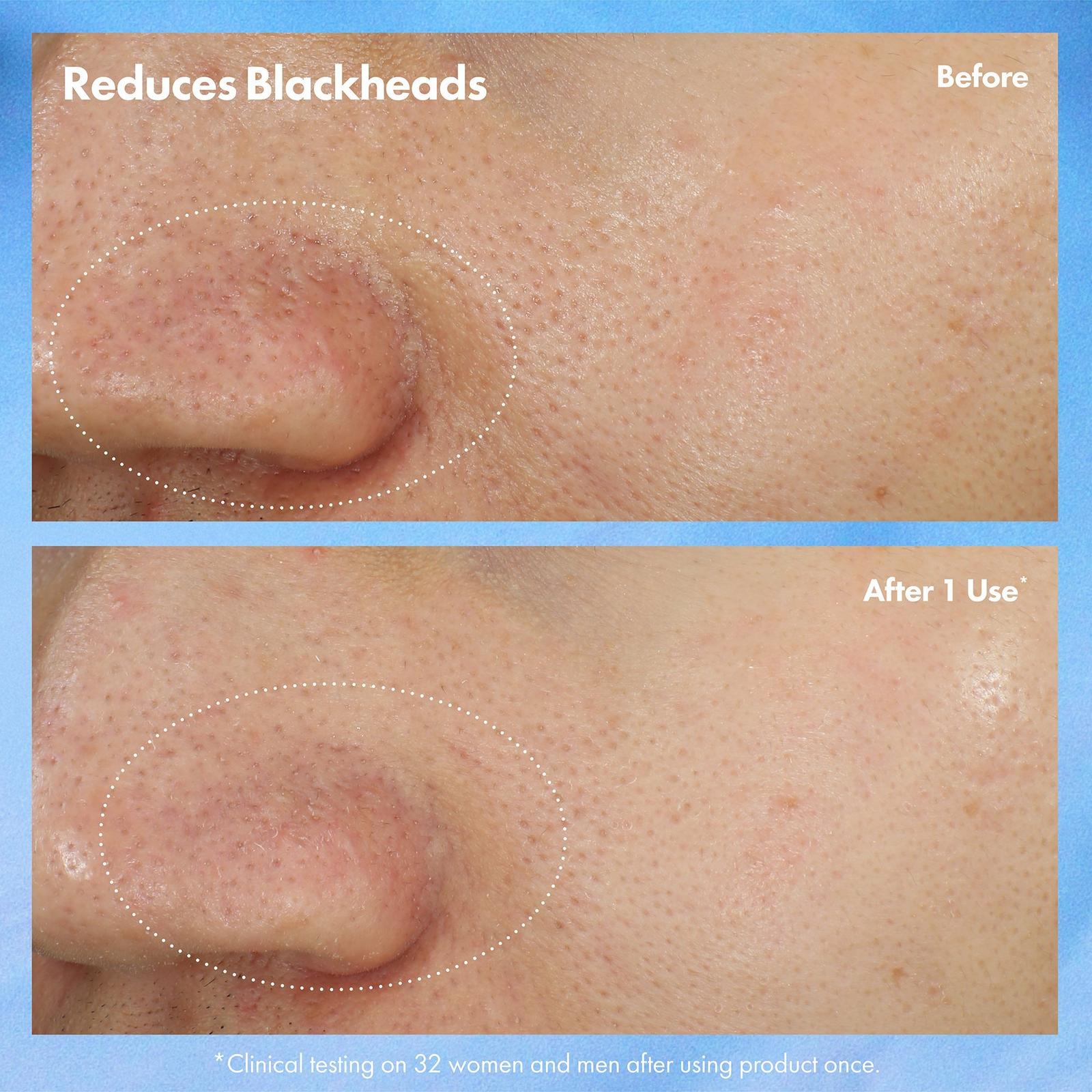 Clear Improvement Blackhead Clearing Mask-to-Scrub