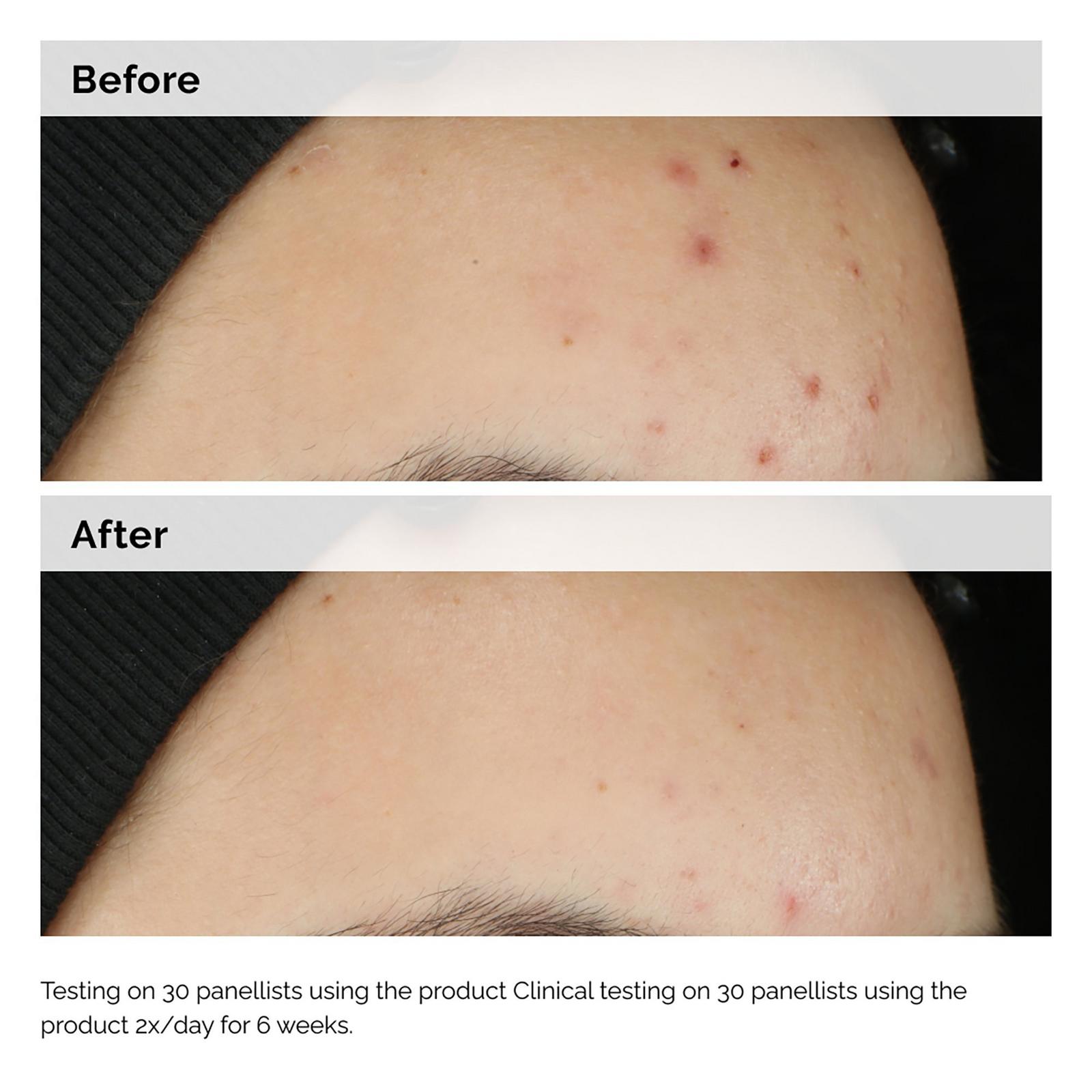 Balancing & Clarifying Serum