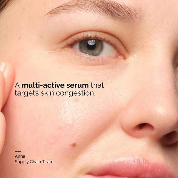 The Ordinary Balancing & Clarifying Serum for Blemish Prone Skin #5