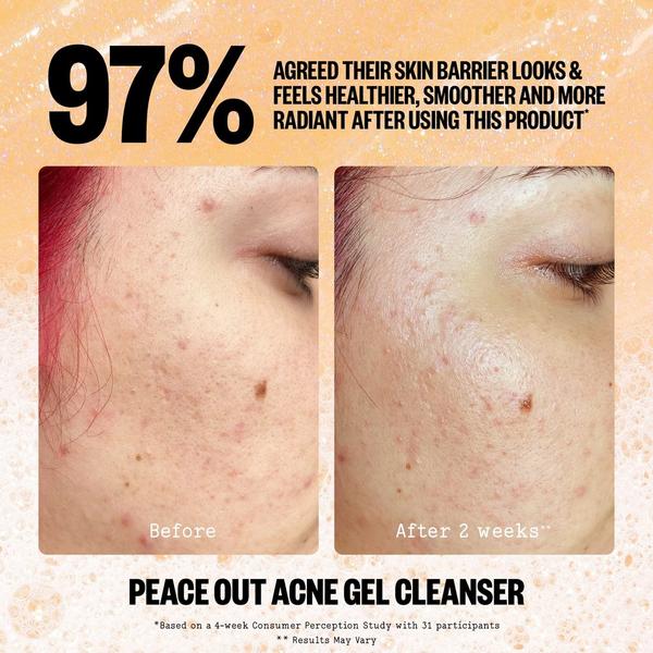 Peace Out 2% Salicylic Acid Acne Gel Cleanser #3