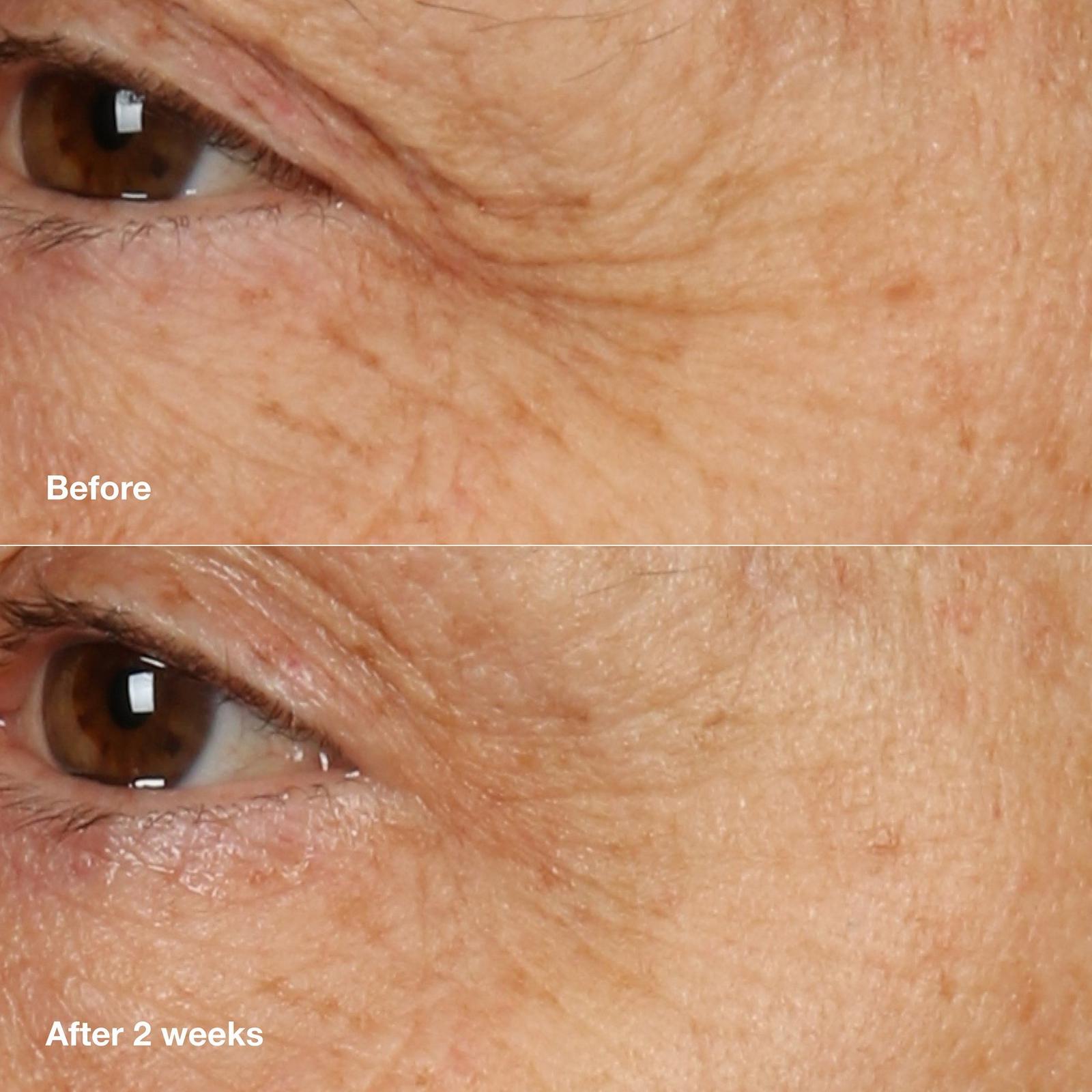 Smart Clinical Repair Overnight Recovery Face Cream + Mask