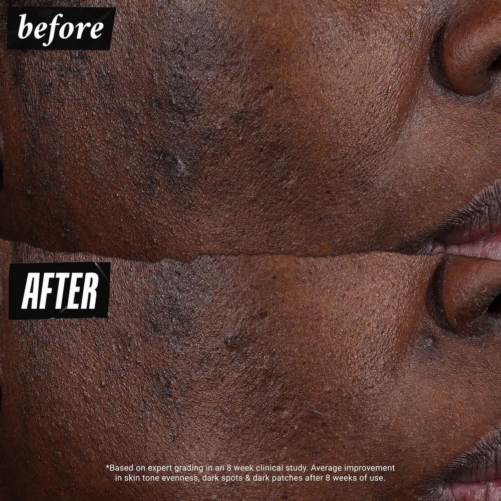 Auto-Tone Discoloration & UV Solution SPF 30