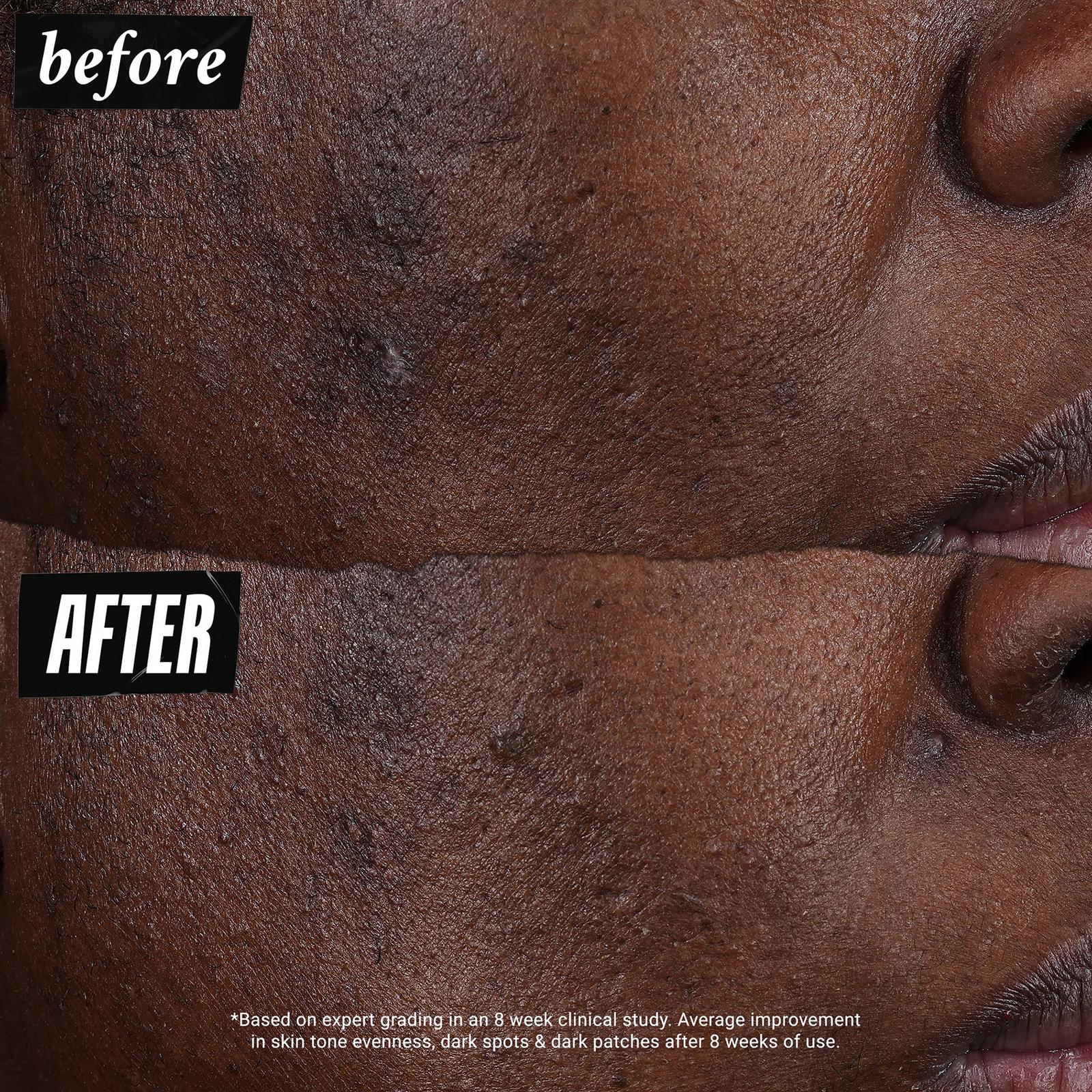 Auto-Tone Discoloration & UV Solution SPF 30