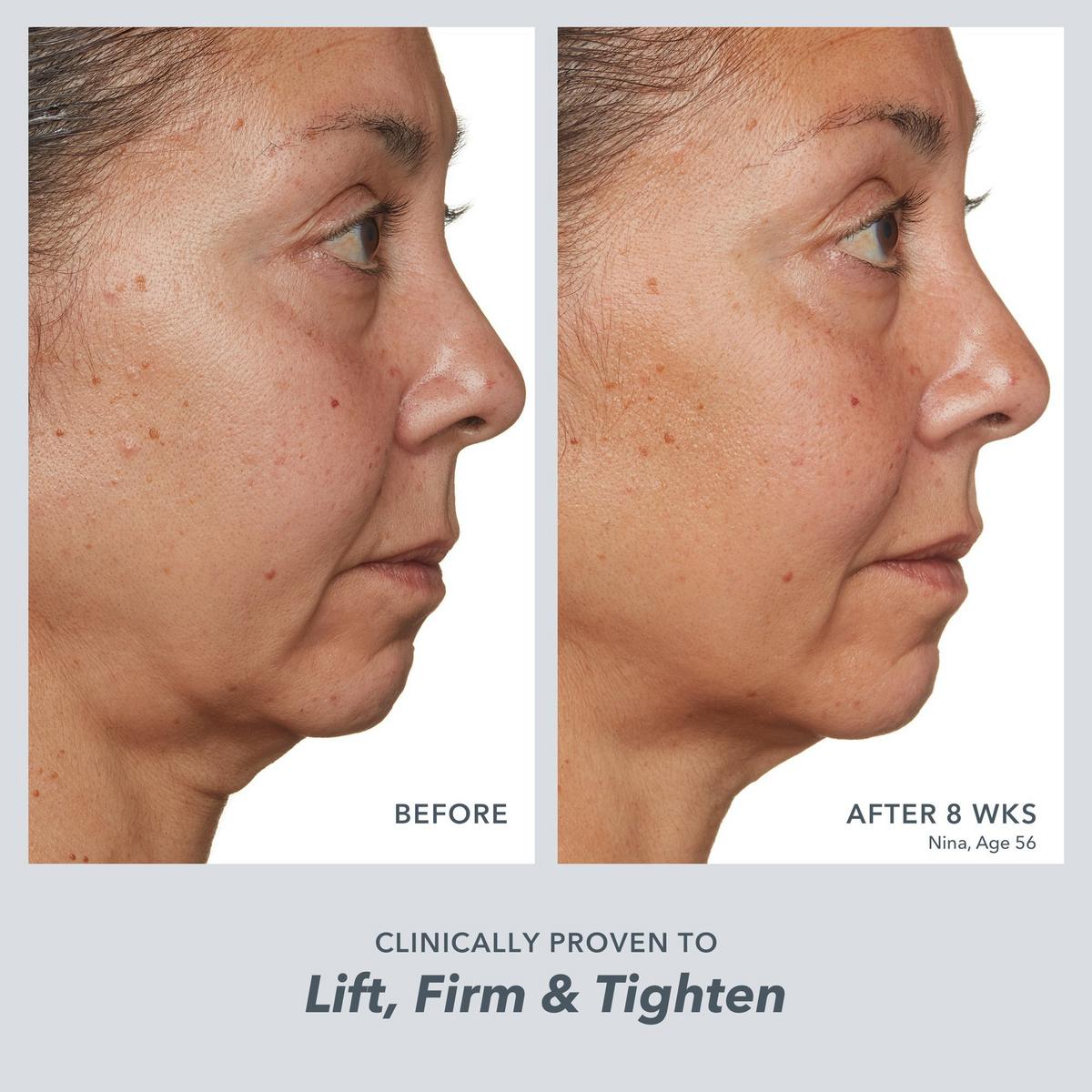 Milk RX Advanced Better Aging Cream