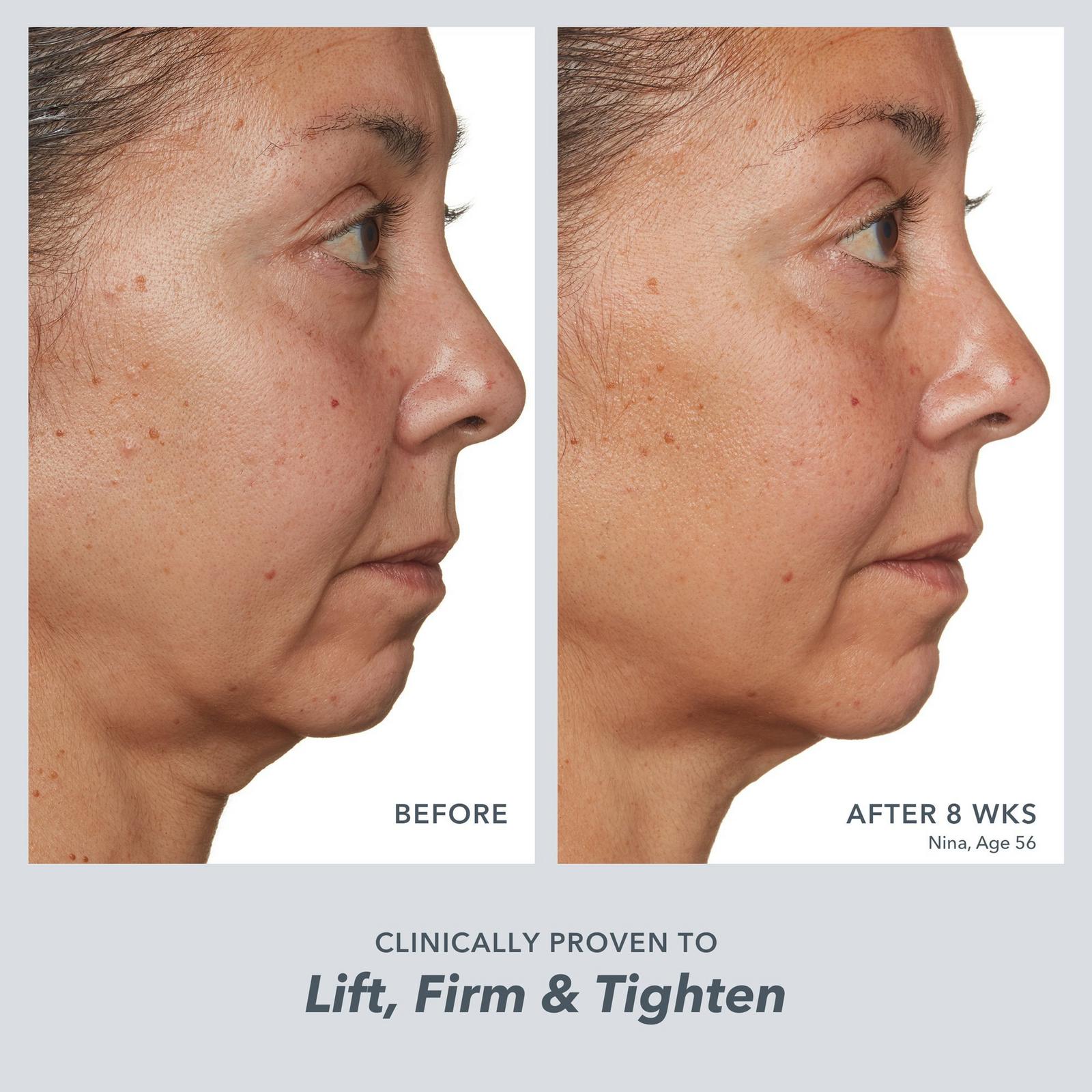 Milk RX Advanced Better Aging Cream