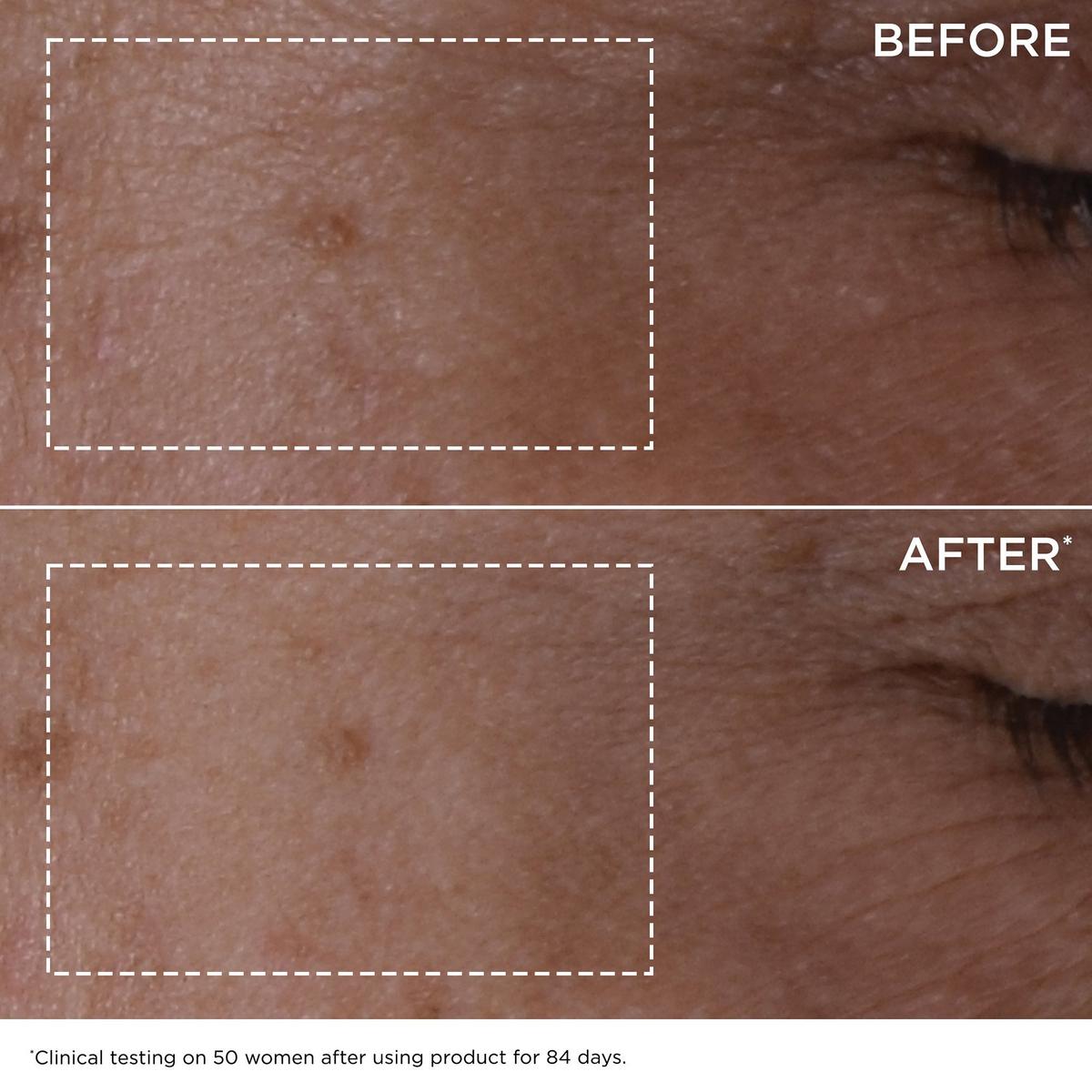 Double Serum Age Defying Concentrate