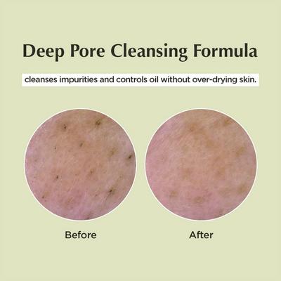 Deep Pore Cleansing Soda Foam