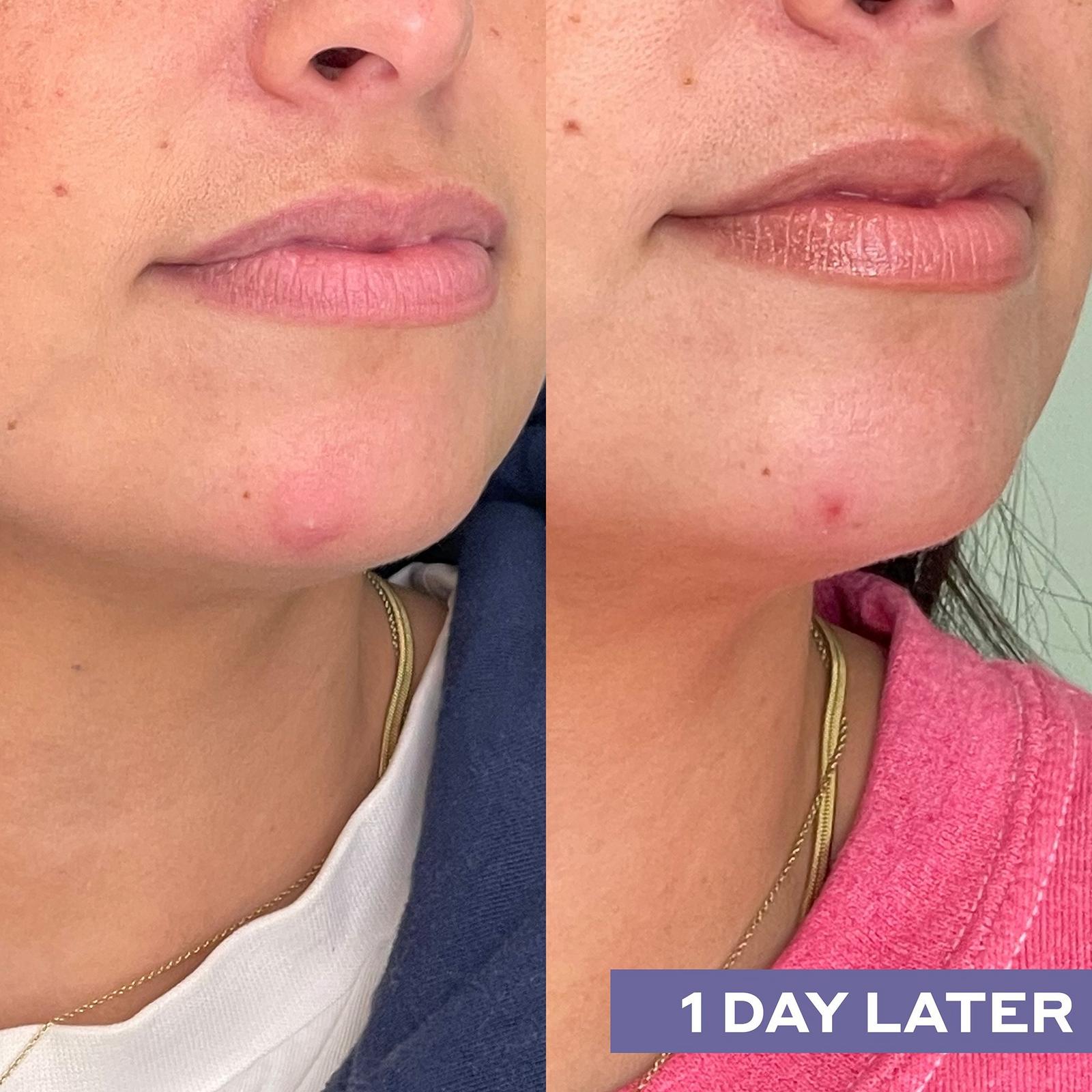 Repairing Facial Spray With Hypochlorous Acid