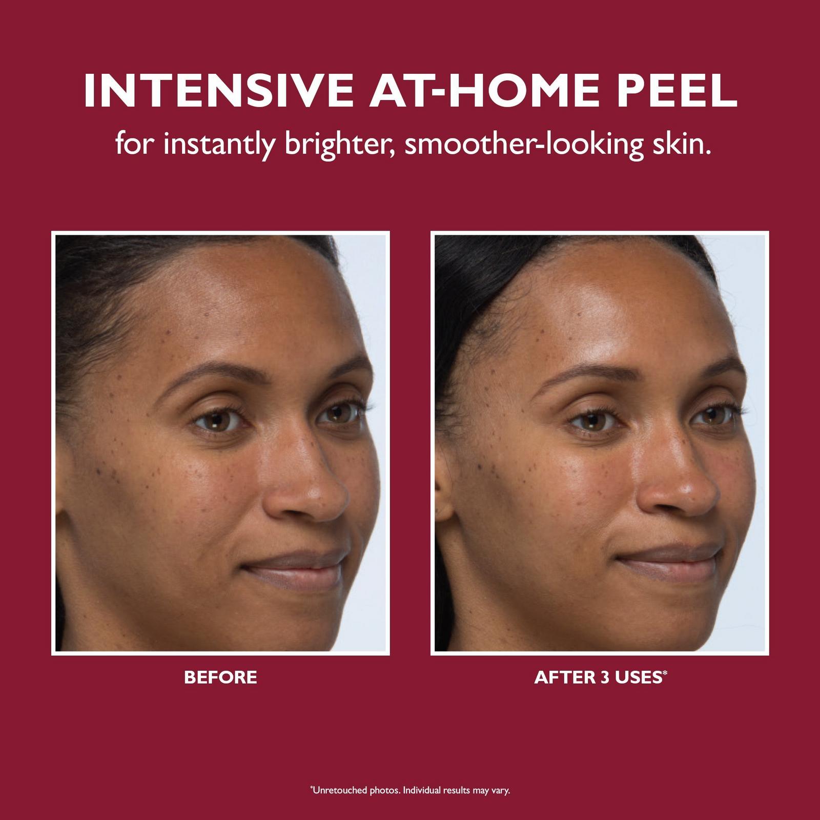 Even Smoother Instant Reveal Facial Peel