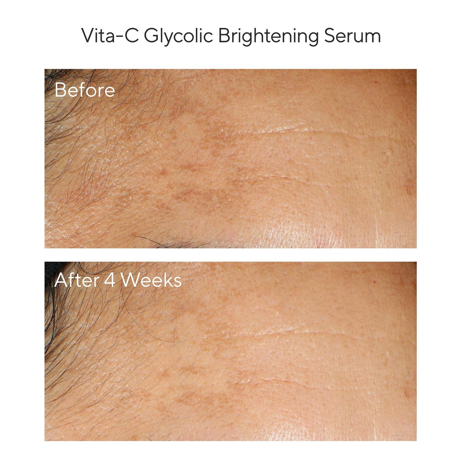 Brighten & Even Tone with Vitamin C Trial Kit