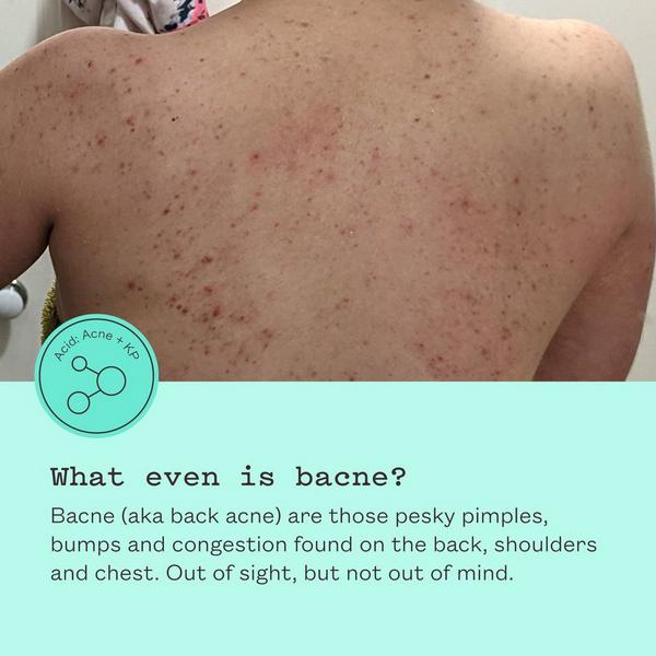 frank body Triple Acid Body Mist #6