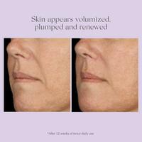 Exuviance Advanced Total Correct Serum #5