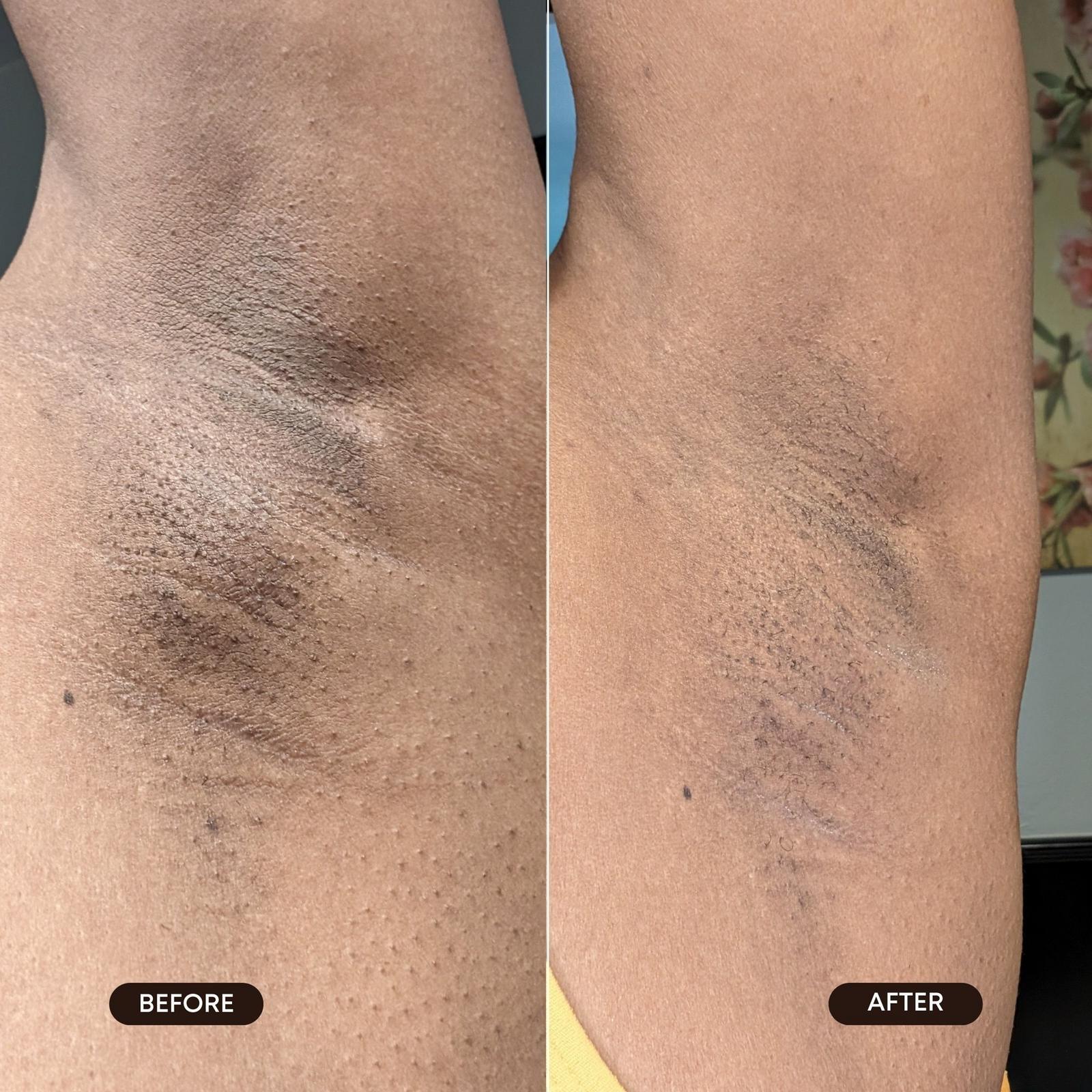 After Dark Brightening Gel for Dark Spots