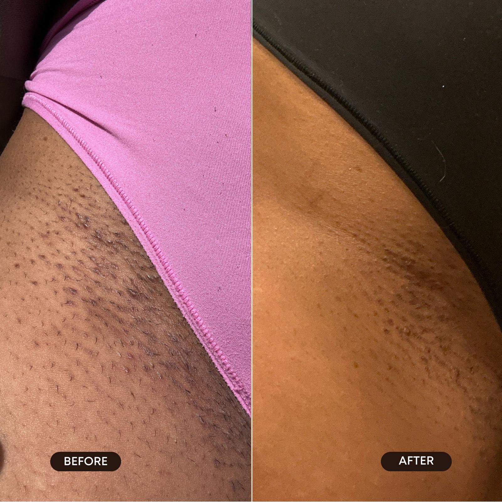 After Dark Brightening Gel for Dark Spots