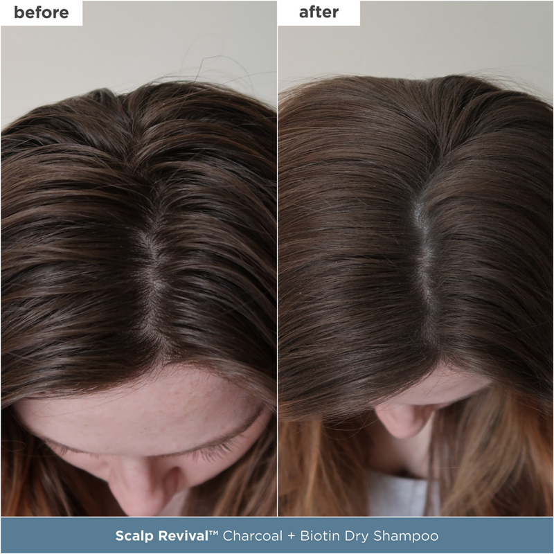 Briogeo - Scalp Revival Scalp Care Essentials Gift Set | Ulta Beauty