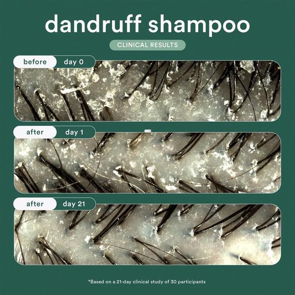 Verb Dandruff Shampoo with Salicylic Acid for Dry and Flaky Scalp #6