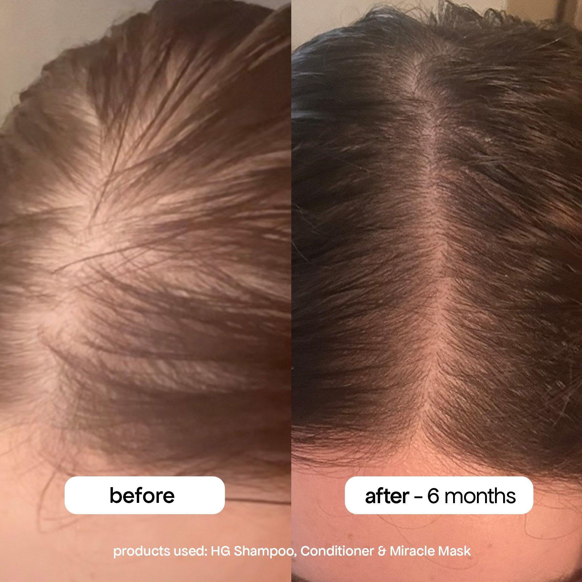 Маска для редеющих волос Bondi Boost HG Miracle с розмарином — фото 4