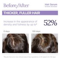 Keranique Growth Activator Hair Serum #6