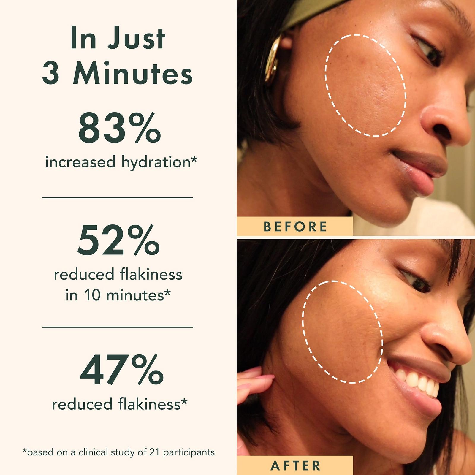 Miracle Clear Brightening Triple Acid Exfoliant
