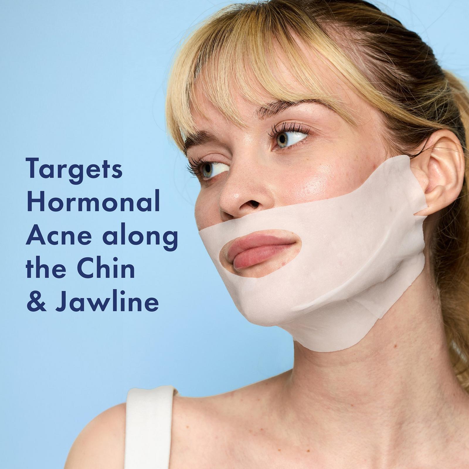 Miracle Clear Retinol Chin Mask Set