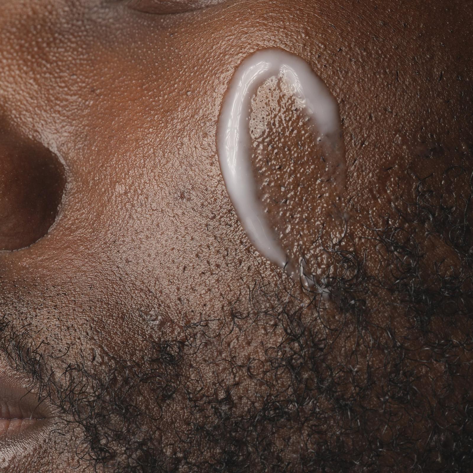 Niacinamide 5% Face and Body Emulsion