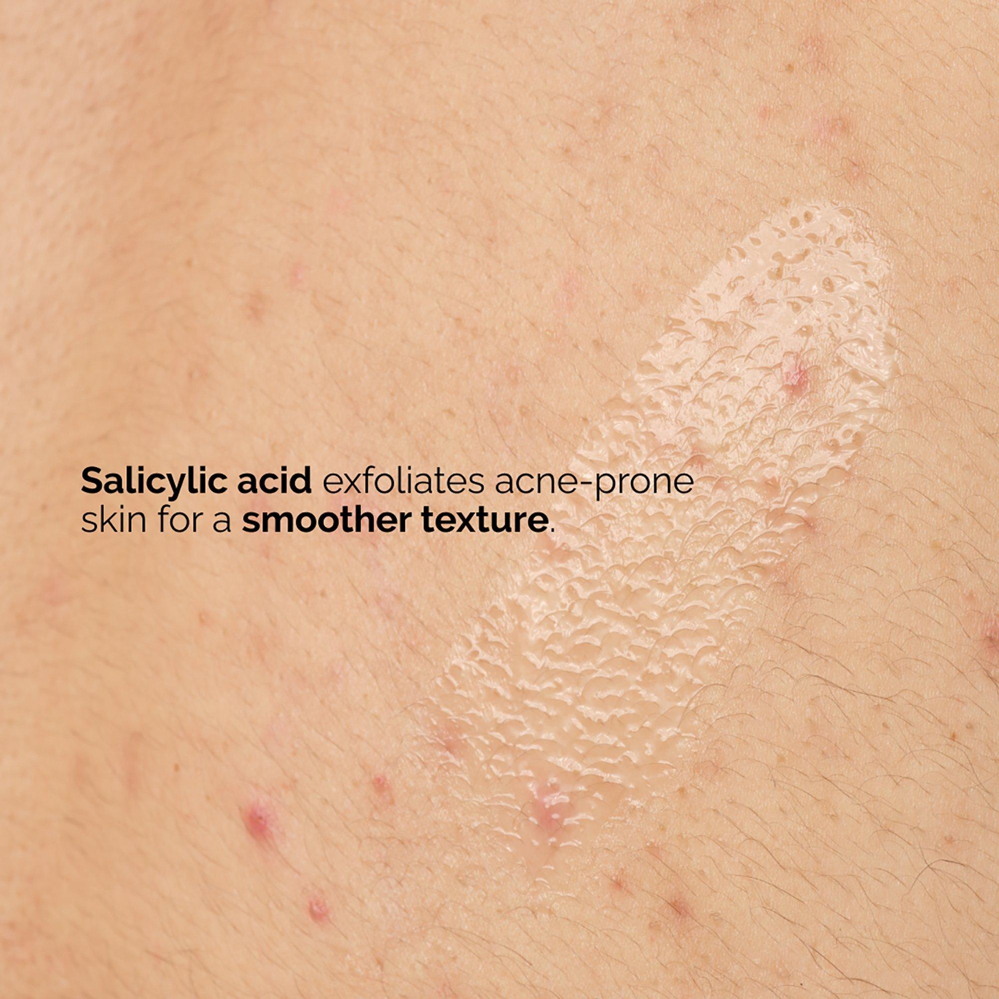 Отшелушивающая сыворотка для тела против акне The Ordinary Salicylic Acid 0.5% — фото 6
