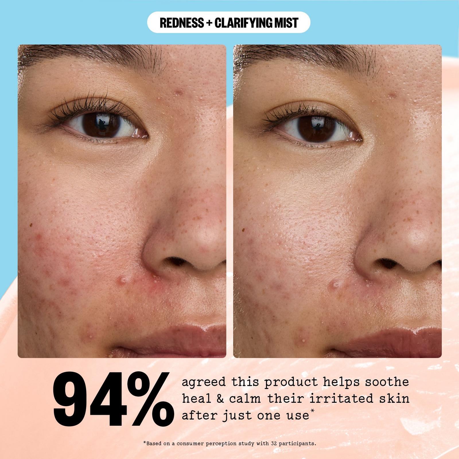 Redness Reducing + Clarifying Facial Mist
