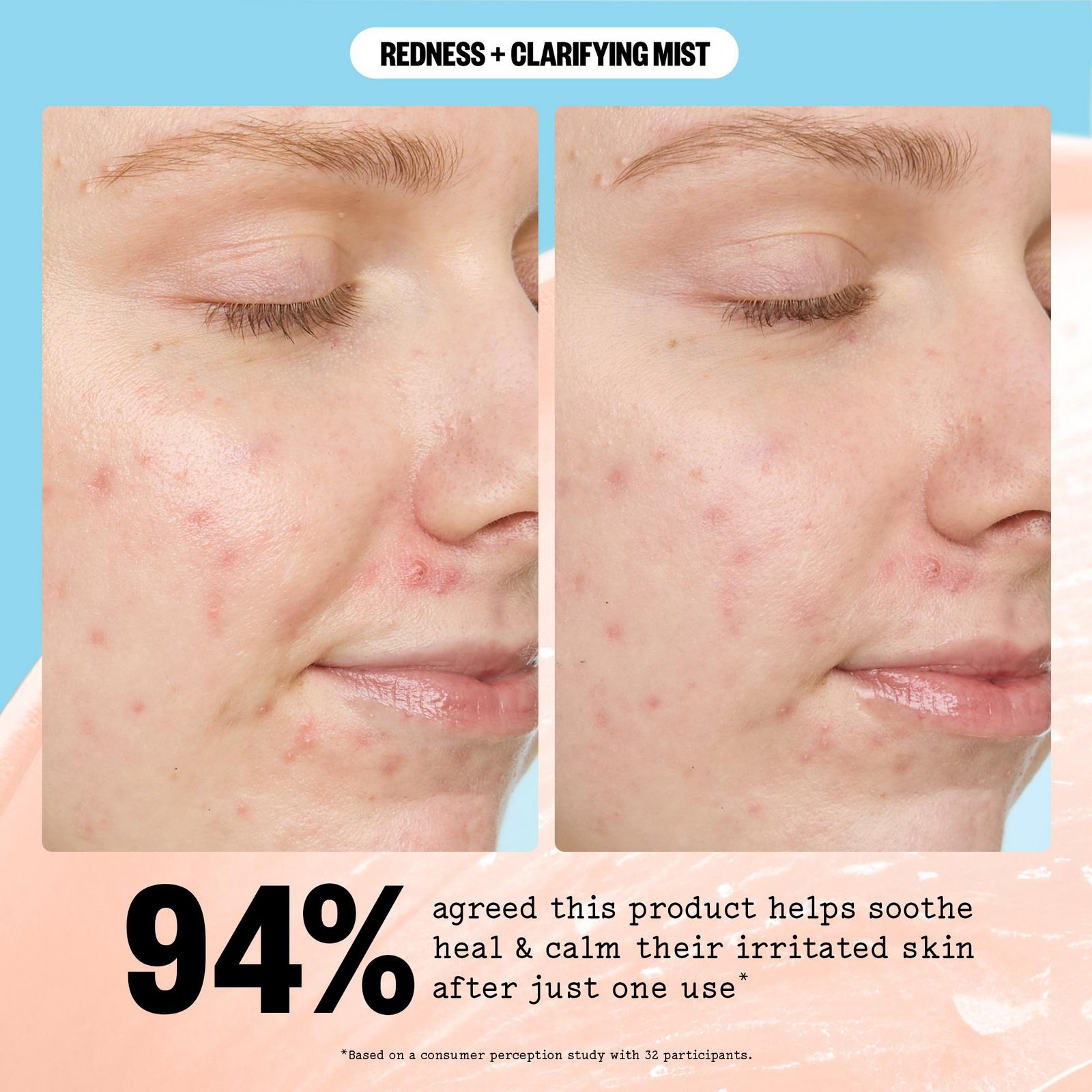 Redness Reducing + Clarifying Facial Mist