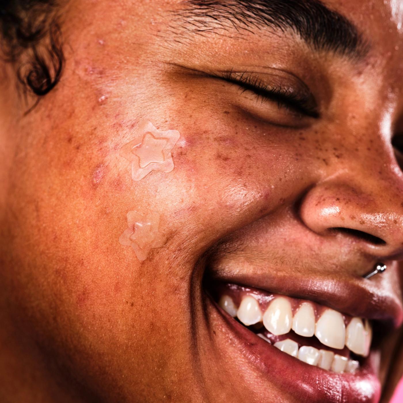 Hydro-Star Clear Pimple Patches