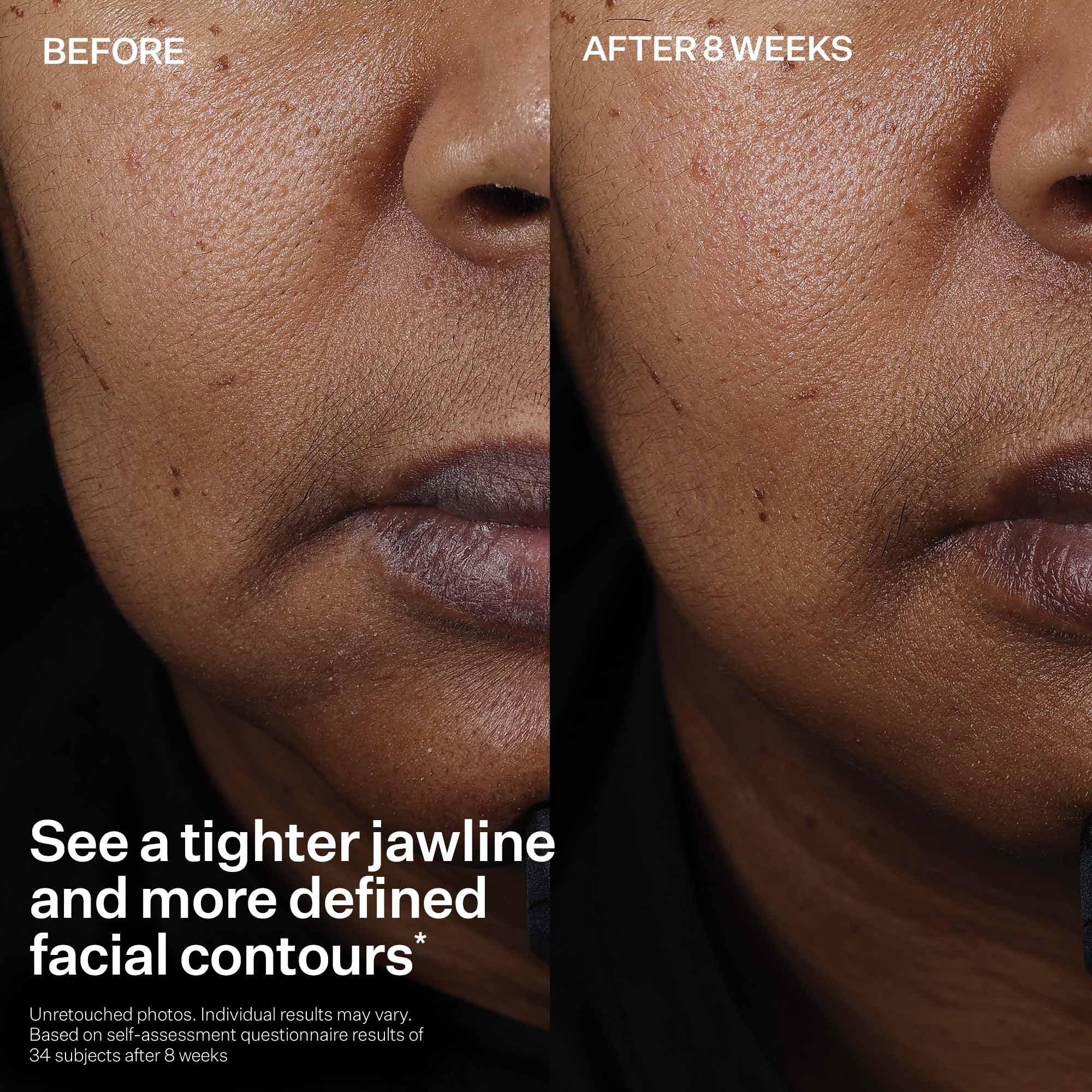 Сыворотка-лифтинг для лица StriVectin Peptight — фото 7
