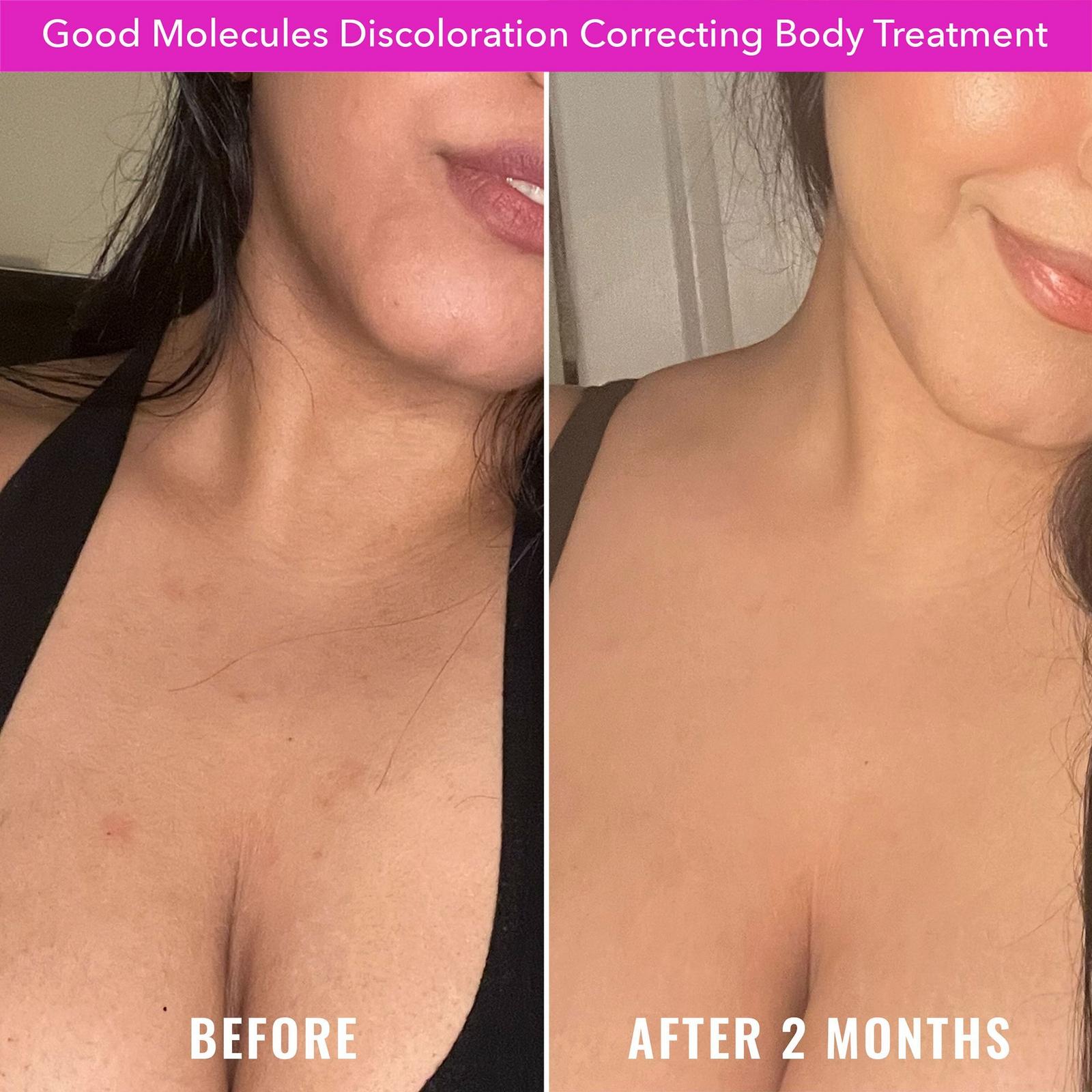 Discoloration Correcting Body Treatment