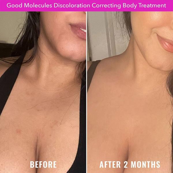 Good Molecules Discoloration Correcting Body Treatment #4