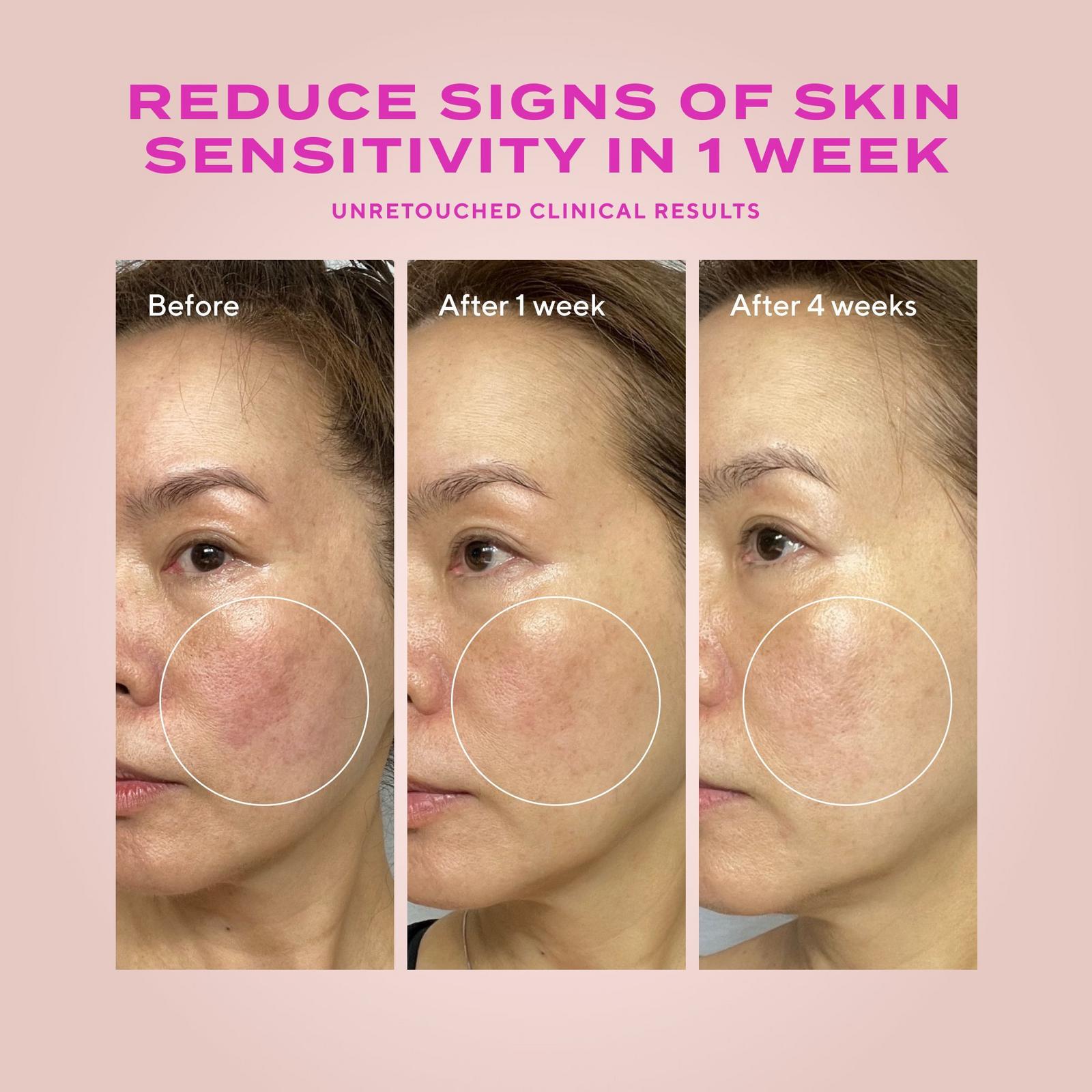 Sensitive Skin Gentle Resurfacing Serum