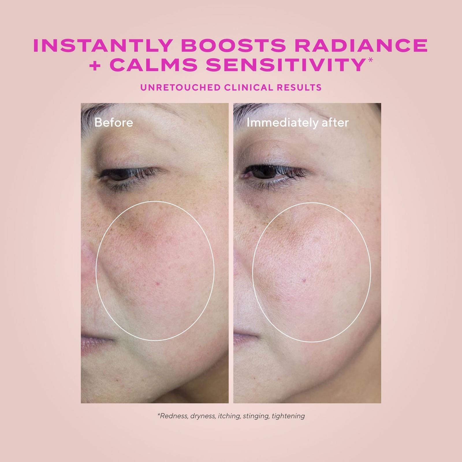 Sensitive Skin Gentle Resurfacing Serum