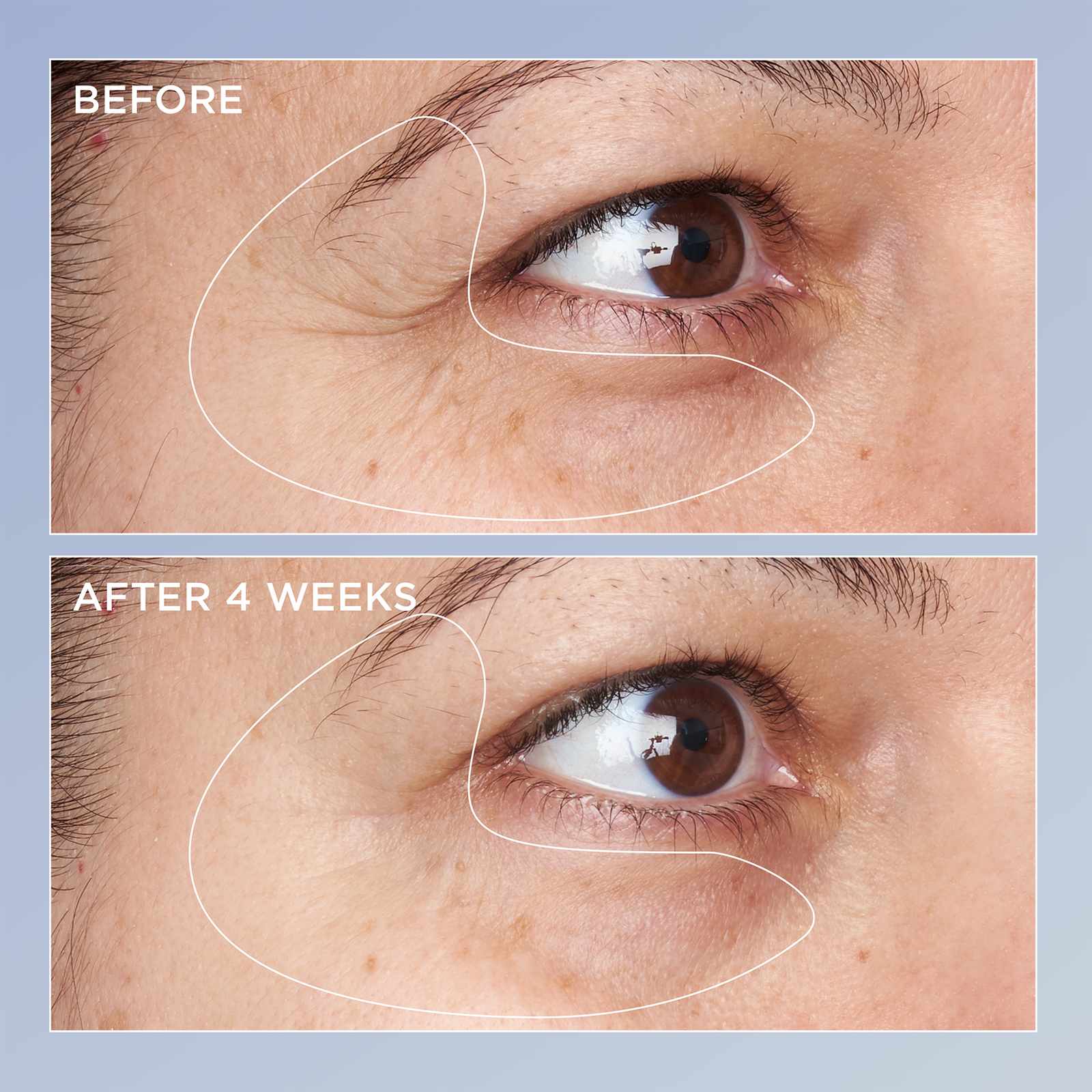 High Potency Triple Retinol Renewal Eye Serum