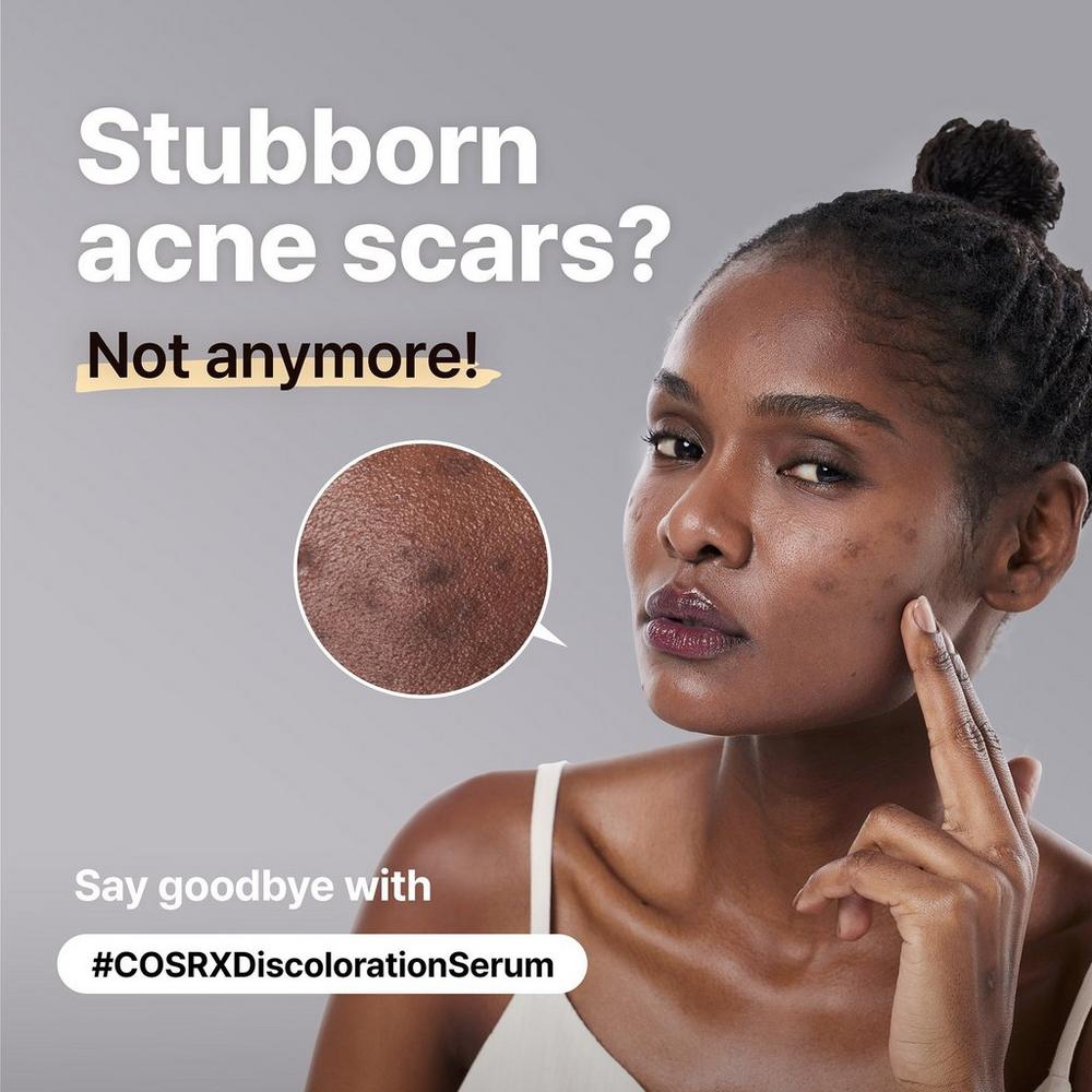 The Alpha-Arbutin 2 Discoloration Care Serum