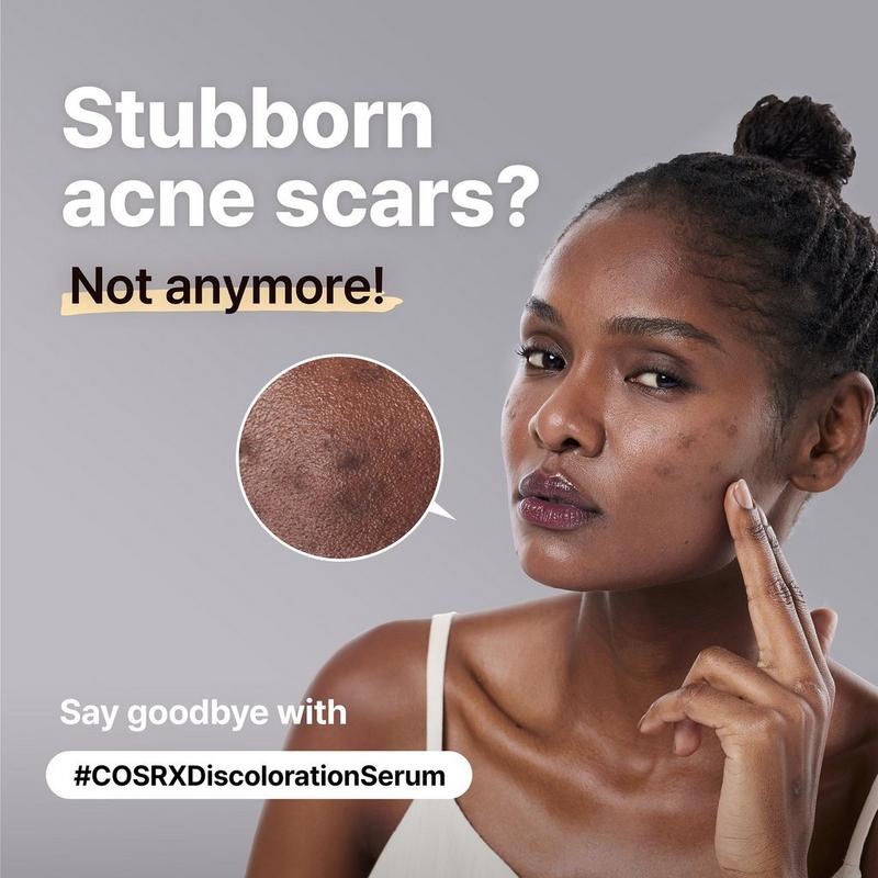 COSRX The Alpha-Arbutin 2 Discoloration Care Serum #2