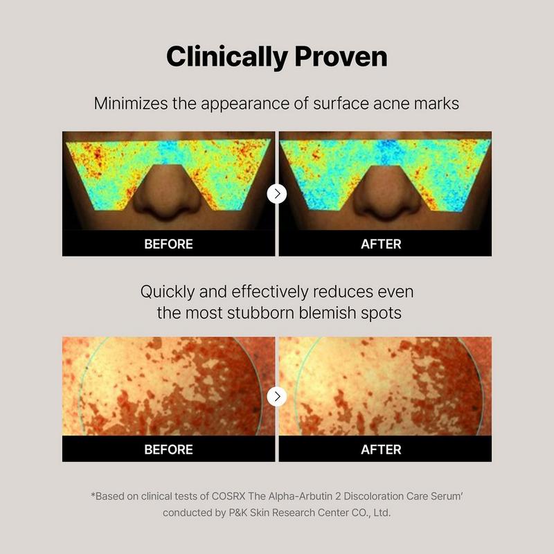 COSRX The Alpha-Arbutin 2 Discoloration Care Serum #7