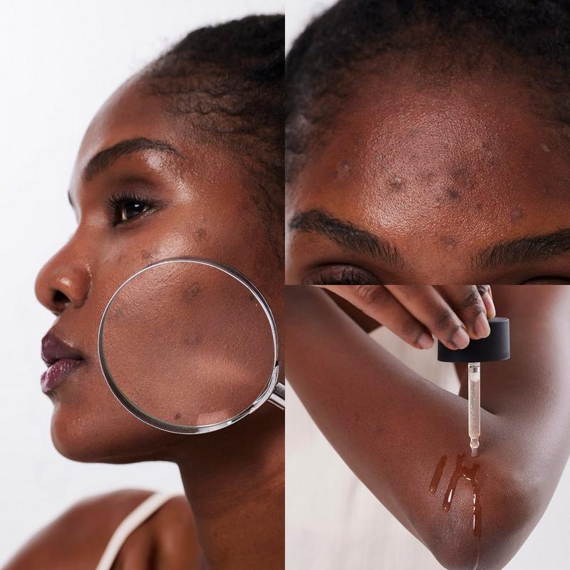 COSRX The Alpha-Arbutin 2 Discoloration Care Serum #8