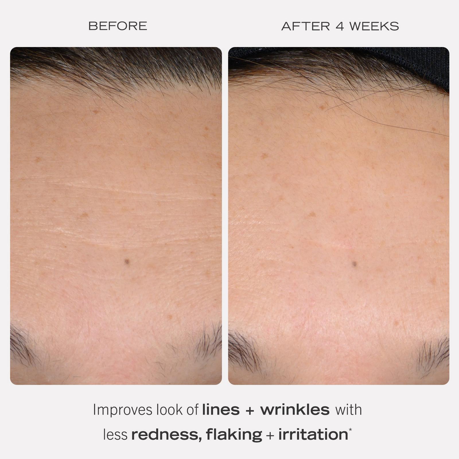 0.3% Retinol Complex Face Serum with Peptides