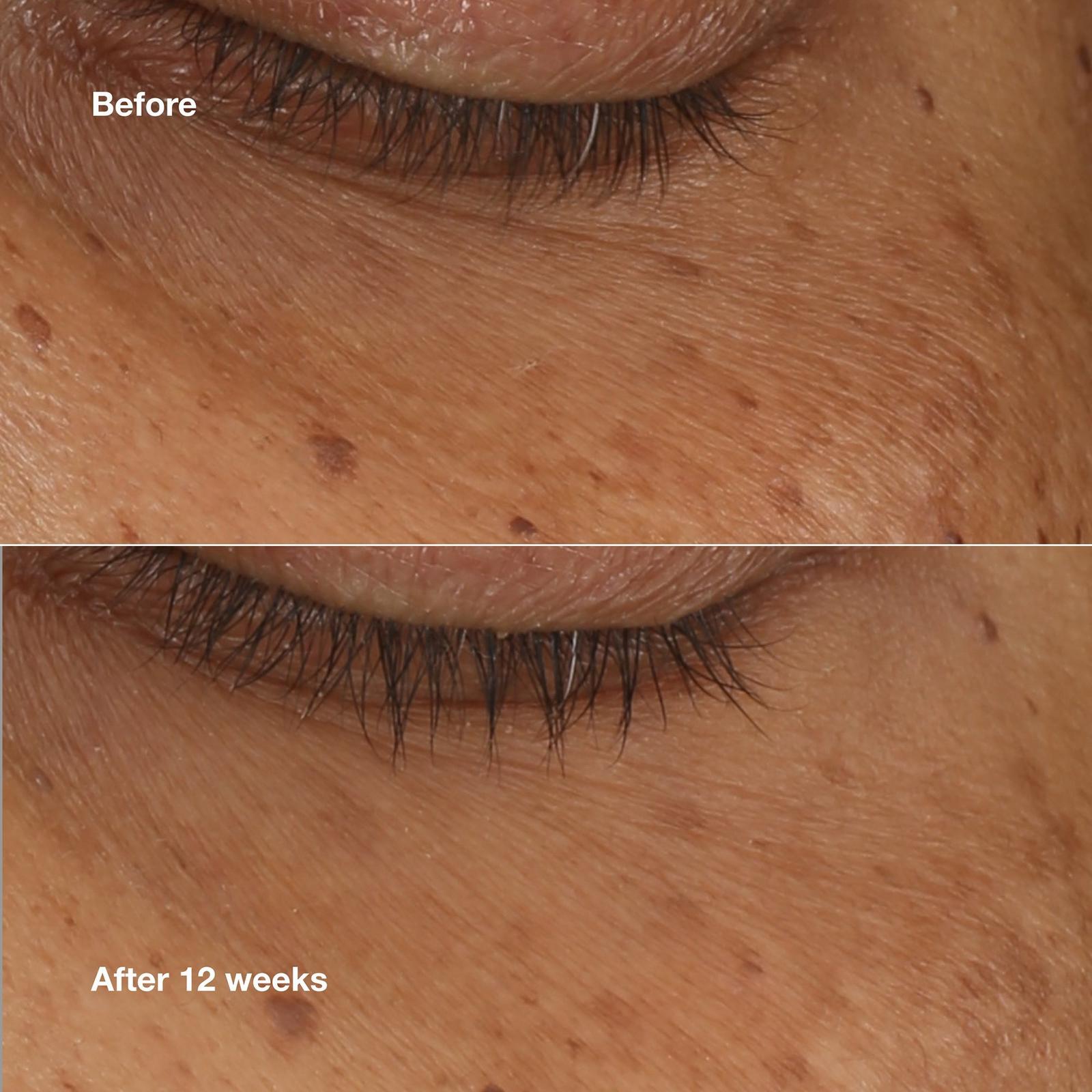 All About Eyes Brightening Serum Concentrate with Retinoid