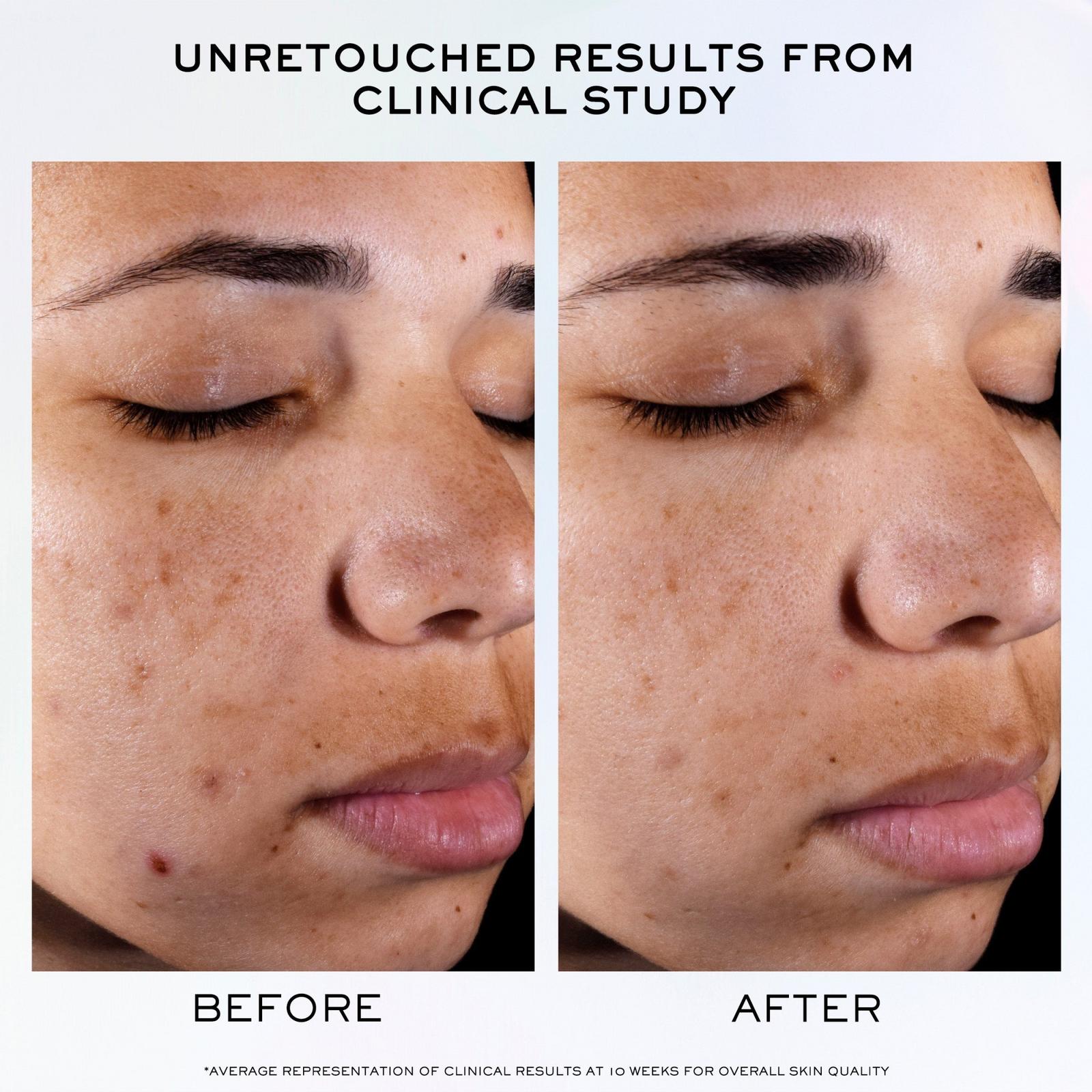 Clarifique Pro-Solution Brightening & Dark Spot Reducing Serum